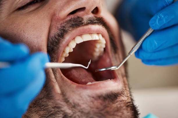 Best Tooth Infection Emergency Dentist  in Tres Arroyos, NM